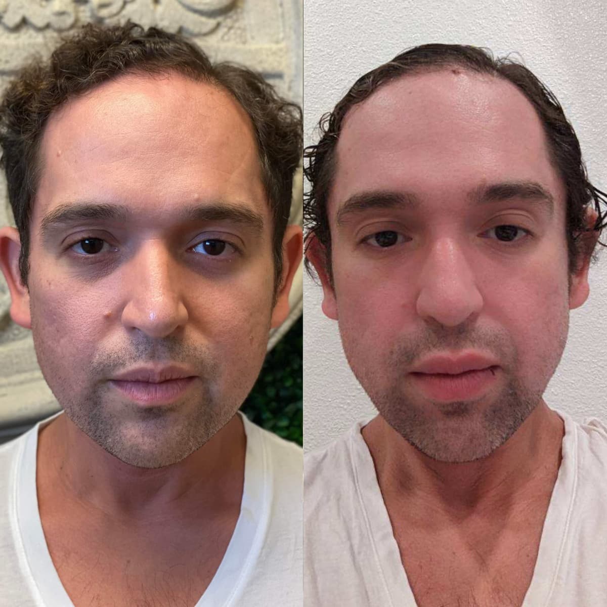 C.G. before