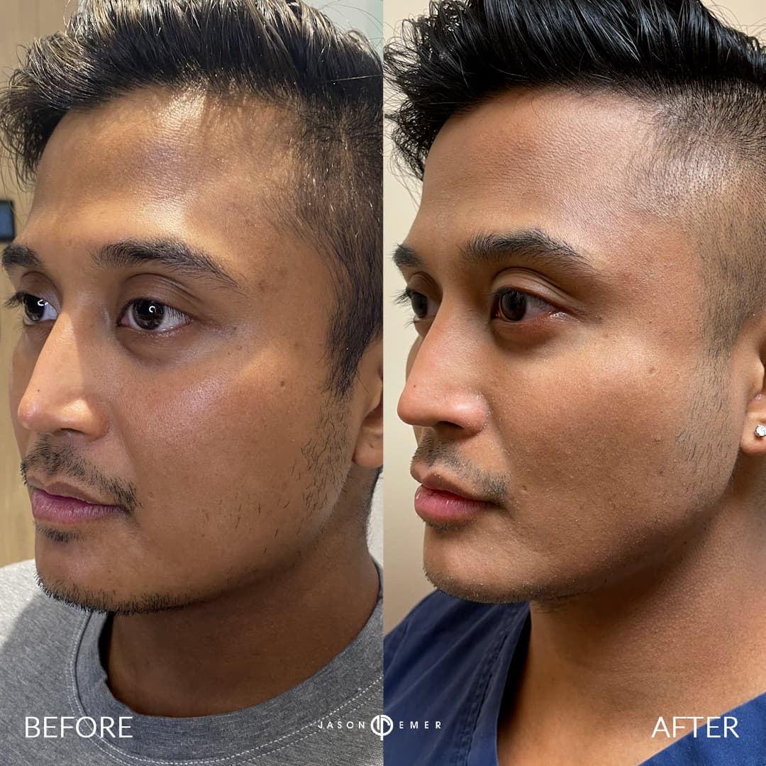 D.I. before