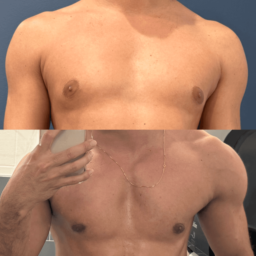 F.L. before