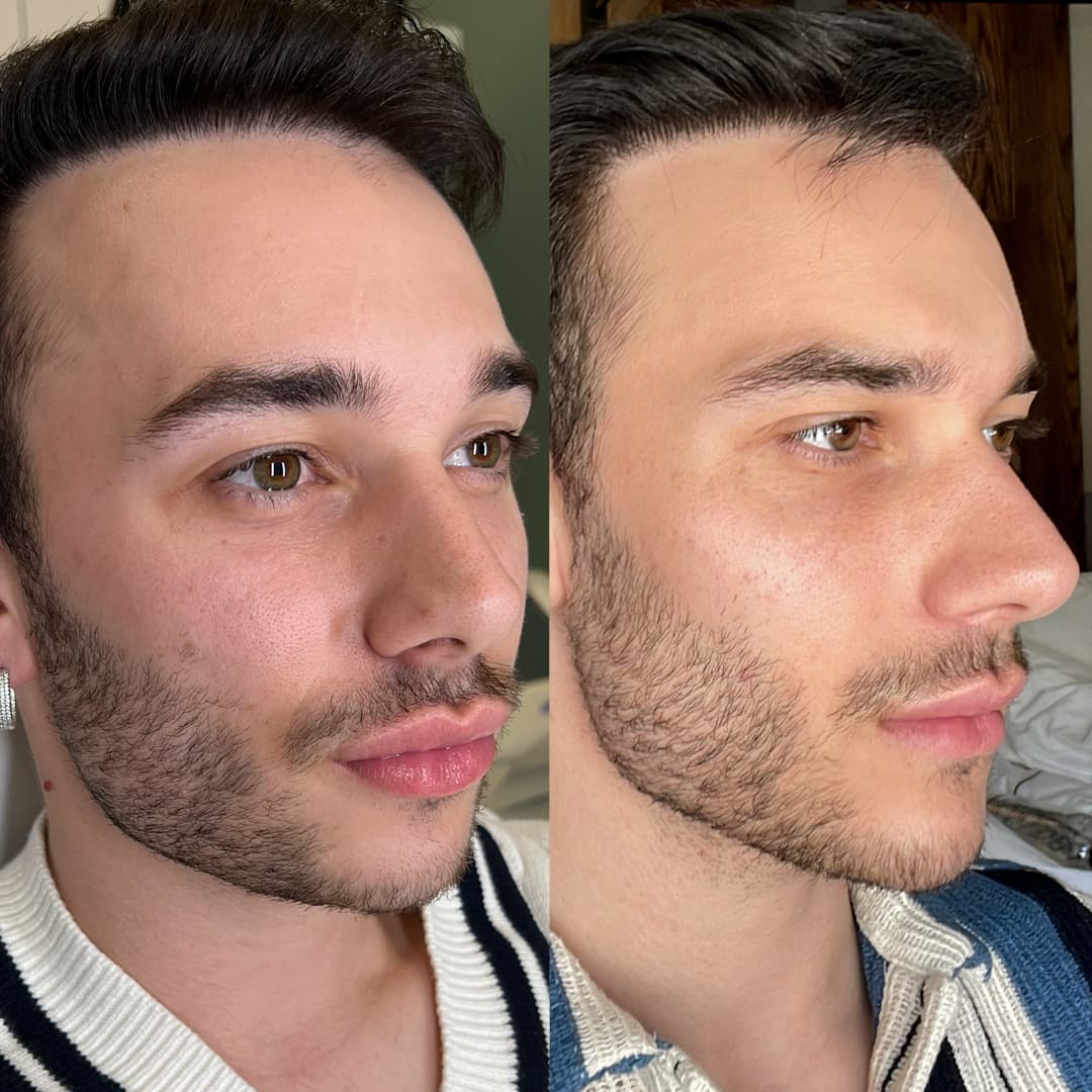 L.R. before