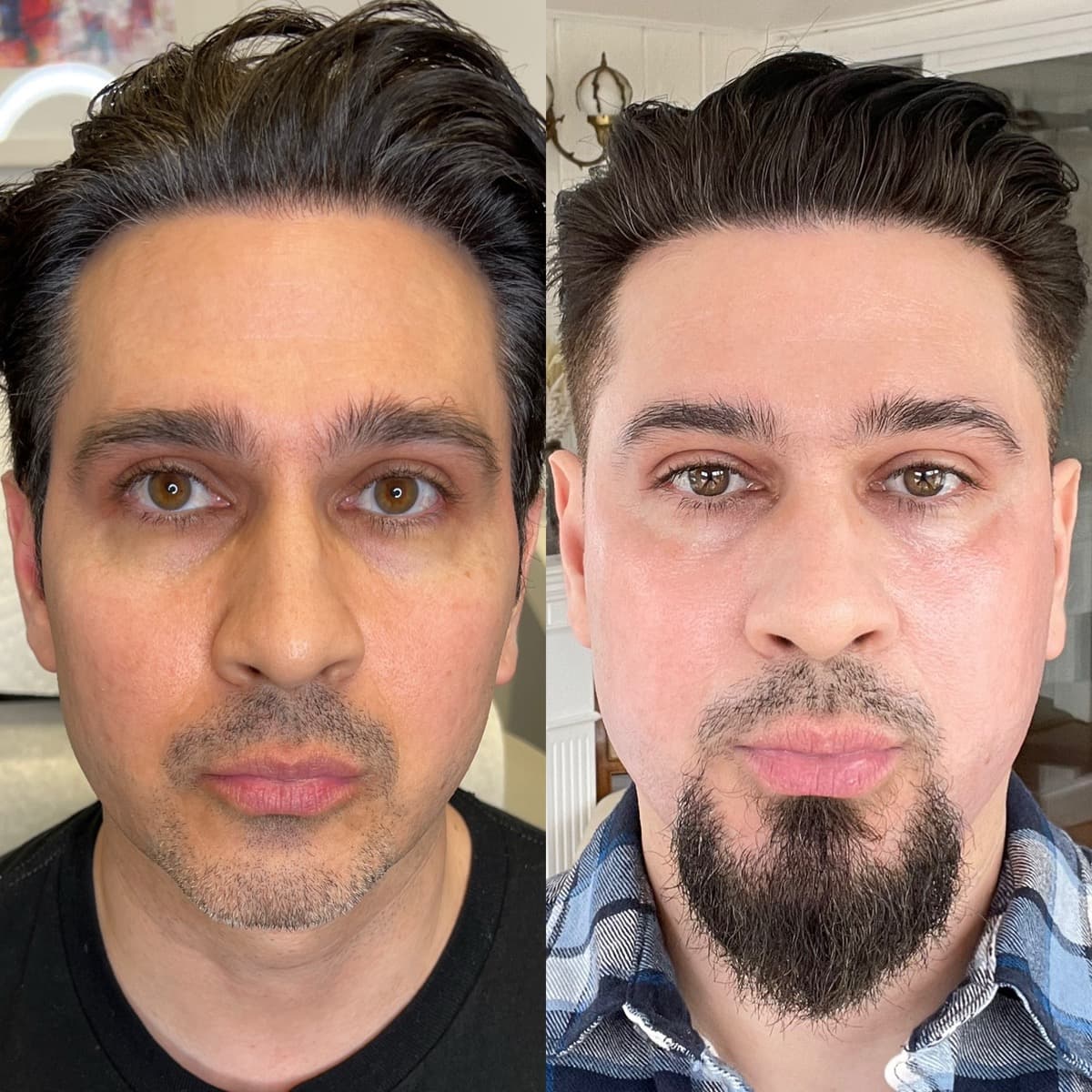 R.Z. before