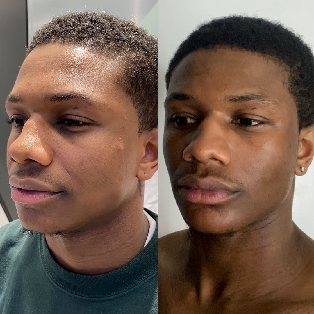 Z.S. before